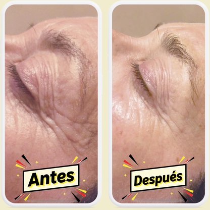 Elimina Arrugas en 7 Días con ZenGlow