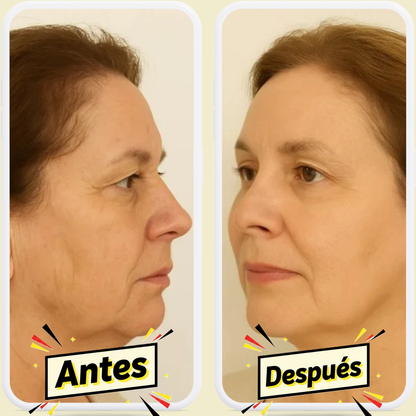 Elimina Arrugas en 7 Días con ZenGlow